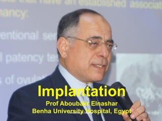 Implantation
Prof Aboubakr Elnashar
Benha University Hospital, EgyptAboubakr Elnashar
 