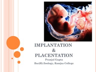 IMPLANTATION
&
PLACENTATION
Pranjal Gupta
Bsc(H) Zoology, Ramjas College
 