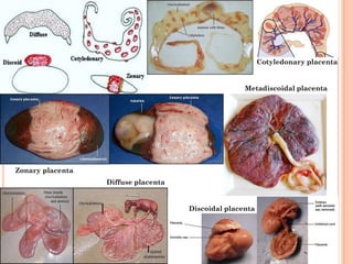 Zonary placenta
Diffuse placenta
Discoidal placenta
Metadiscoidal placenta
Cotyledonary placenta
 