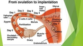 Implantation Example Implantation | PPTX