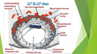 Implantation Example Implantation | PPTX