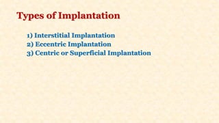 Types of Implantation
1) Interstitial Implantation
2) Eccentric Implantation
3) Centric or Superficial Implantation
 
