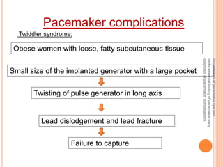 Pacemaker Widdler fundamentals of pacemaker | PPTX