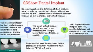 04 ALL on 4
***Two straight implants are inserted in the anterior region
(usually lateral incisor) and two dorsally tilted...