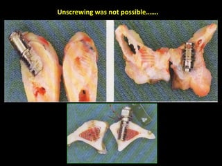 Unscrewing was not possible…….
 