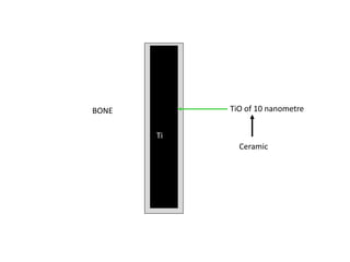 BONE
Ti
TiO of 10 nanometre
Ceramic
 