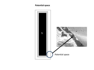 Ti
Potential space
Potential space
 