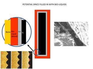 TiO
Ti
Bio-
Liquid
(Blood)
Bone
PETENTIAL SPACE FILLED IN WITH BIO-LIQUIDS
 