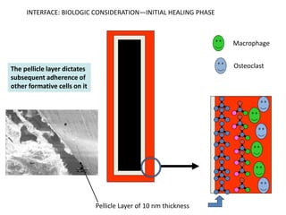 Macrophage
Osteoclast
Pellicle Layer of 10 nm thickness
The pellicle layer dictates
subsequent adherence of
other formative cells on it
INTERFACE: BIOLOGIC CONSIDERATION—INITIAL HEALING PHASE
 