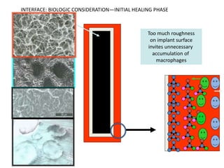 Too much roughness
on implant surface
invites unnecessary
accumulation of
macrophages
INTERFACE: BIOLOGIC CONSIDERATION—INITIAL HEALING PHASE
 