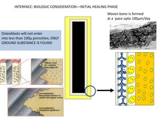 Woven bone is formed
at a pace upto 100µm/day
Osteoblasts will not enter
into less than 100µ porosities; ONLY
GROUND SUBSTANCE IS FOUND
INTERFACE: BIOLOGIC CONSIDERATION—INITIAL HEALING PHASE
 