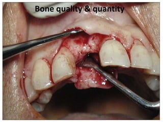 Bone quality & quantity
 