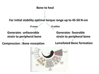 Bone to heal
For initial stability optimal torque range up to 45-50 N-cm
Generates unfavorable
strain to peripheral bone
Compression : Bone resorption
If more If within
Generates favorable
strain to peripheral bone
Lamellated Bone formation
 