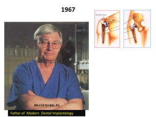 Father of Modern Dental Implantology
BRANEMARK, P.I.
1967
 