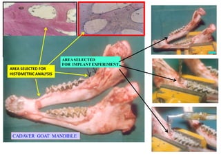 [ Pal et al,1995 ]
AREASELECTED
FOR IMPLANT EXPERIMENT
CADAVER GOAT MANDIBLE
AREA SELECTED FOR
HISTOMETRIC ANALYSIS
[Pal et al,1997 ]
 