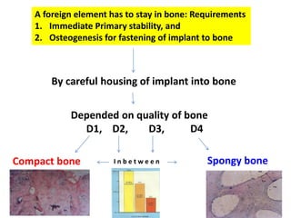 By careful housing of implant into bone
Depended on quality of bone
D1, D2, D3, D4
Compact bone Spongy bone
I n b e t w e e n
A foreign element has to stay in bone: Requirements
1. Immediate Primary stability, and
2. Osteogenesis for fastening of implant to bone
 
