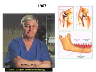 Father of Modern Dental Implantology
BRANEMARK, P.I.
1967
 