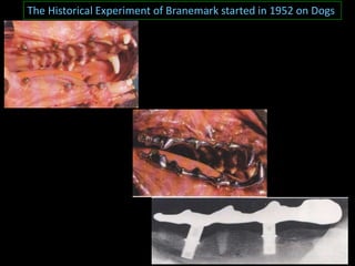 The Historical Experiment of Branemark started in 1952 on Dogs
 