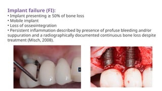 Implant failure (FI):
• Implant presenting 50% of bone loss
≥
• Mobile implant
• Loss of osseointegration
• Persistent inflammation described by presence of profuse bleeding and/or
suppuration and a radiographically documented continuous bone loss despite
treatment (Misch, 2008).
 