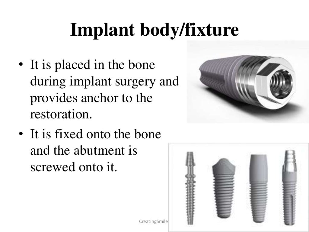 Implant Biomaterials