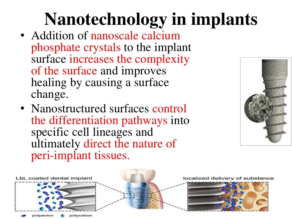 Implant Biomaterials