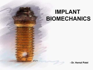 IMPLANT
BIOMECHANICS
- Dr. Hemal Patel
 