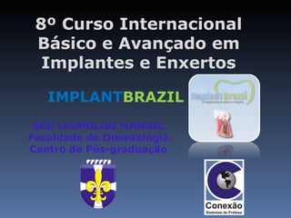 8º Curso Internacional
 Básico e Avançado em
  Implantes e Enxertos

   IMPLANTBRAZIL
 SÃO LEOPOLDO MANDIC
Faculdade de Odontologia
Centro de Pós-graduação
 