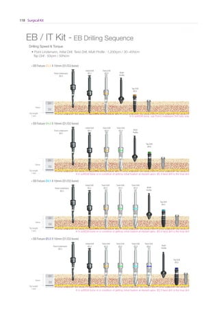 Surgical Kit118
* Scale 1 : 1* Scale 1 : 1
EB / IT Kit - EB Drilling Sequence
Drilling Speed  Torque
※ In soft(D4) bone or in condition of getting initial fixation at implant apex, Ø3.4 twist drill is the final drill
※ In soft(D4) bone or in condition of getting initial fixation at implant apex, Ø3.9 twist drill is the final drill
※ In soft(D4) bone or in condition of getting initial fixation at implant apex, Ø2.9 twist drill is the final drill
※ In soft(D4) bone, use Point Lindemann Drill fully only
• Point Lindemann, Initial Drill, Twist Drill, Multi Profile : 1,200rpm / 30~45Ncm
Tap Drill : 50rpm / 50Ncm
D1
D2
10mm
Tip Length
1 mm
Point Lindemann
Ø2.5
Multi
Profile
Tap Drill
Ø3.5
• EB Fixture Ø3.5 X 10mm (D1/D2 bone)
Multi
Profile
Tap Drill
Ø4.0
D1
D2
10mm
Tip Length
1 mm
Point Lindemann
Ø2.5
• EB Fixture Ø4.0 X 10mm (D1/D2 bone)
Multi
Profile
Tap Drill
Ø4.5
D1
D2
10mm
Tip Length
1 mm
Point Lindemann
Ø2.5
• EB Fixture Ø4.5 X 10mm (D1/D2 bone)
Multi
Profile
Tap Drill
Ø5.0
D1
D2
10mm
Tip Length
1 mm
Point Lindemann
Ø2.5
• EB Fixture Ø5.0 X 10mm (D1/D2 bone)
Initial Drill
Ø2.2
Twist Drill
Ø2.9
Initial Drill
Ø2.2
Twist Drill
Ø2.9
Twist Drill
Ø3.4
Initial Drill
Ø2.2
Twist Drill
Ø2.9
Twist Drill
Ø3.4
Twist Drill
Ø3.9
Initial Drill
Ø2.2
Twist Drill
Ø2.9
Twist Drill
Ø3.4
Twist Drill
Ø3.9
Twist Drill
Ø4.4
Go to Index
 