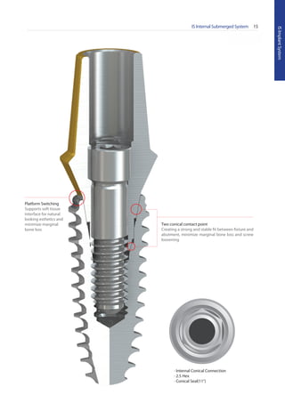 * Scale 1 : 1.1
IS Internal Submerged System 15
ISImplantSystem
* Scale 1 : 1.1
Platform Switching
Supports soft tissue
interface for natural
looking esthetics and
minimize marginal
bone loss
Two conical contact point
Creating a strong and stable fit between fixture and
abutment, minimize marginal bone loss and screw
loosening
∙ Internal Conical Connection
∙ 2.5 Hex
∙ Conical Seal(11°)
Go to Index
 