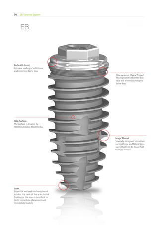 EB External System50
* Scale 1 : 1.1* Scale 1 : 1.1
RBM Surface
The surface is treated by
RBM(Resorbable Blast Media)
Microgroove-Macro Thread
Microgroove below the bio-
seal will Minimize marginal
bone loss
BioSeal(0.5mm)
Increase sealing of soft tissue
and minimize bone loss
Apex
Powerful and well-defined thread
exist at the peak of the apex. Initial
fixation at the apex is excellent to
both immediate placement and
immediate loading
Magic Thread
Specially designed to endure
vertical force and lateral pres-
sure effectively by lower half
triangle thread
EB
Go to Index
 