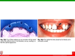 © Ramaiah University of Applied Sciences
24
Faculty of Dental Sciences
 