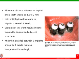 © Ramaiah University of Applied Sciences
25
Faculty of Dental Sciences
• Minimum distance between an implant
and a tooth should be 1.5 to 2 mm.
• Lateral biologic width around an
implant is around 1.3 mm.
• Violation of this width results in bone
loss on the implant and adjacent
structures.
• Minimum distance between 2 implants
should be 3 mm to maintain
interproximal bone height.
 