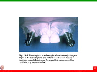 © Ramaiah University of Applied Sciences
26
Faculty of Dental Sciences
 