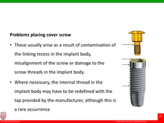 © Ramaiah University of Applied Sciences
27
Faculty of Dental Sciences
Problems placing cover screw
• These usually arise as a result of contamination of
the linking recess in the implant body,
misalignment of the screw or damage to the
screw threads in the implant body.
• Where necessary, the internal thread in the
implant body may have to be redefined with the
tap provided by the manufacturer, although this is
a rare occurrence
 