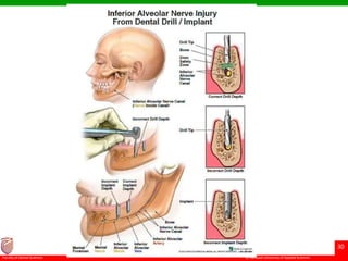 © Ramaiah University of Applied Sciences
30
Faculty of Dental Sciences
 