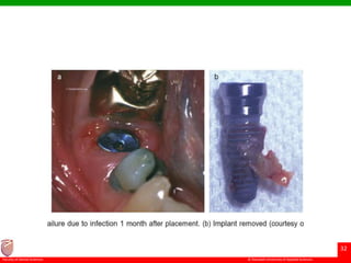 © Ramaiah University of Applied Sciences
32
Faculty of Dental Sciences
 