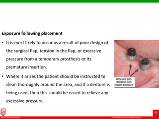 © Ramaiah University of Applied Sciences
33
Faculty of Dental Sciences
Exposure following placement
• It is most likely to occur as a result of poor design of
the surgical flap, tension in the flap, or excessive
pressure from a temporary prosthesis or its
premature insertion.
• Where it arises the patient should be instructed to
clean thoroughly around the area, and if a denture is
being used, then this should be eased to relieve any
excessive pressure.
 