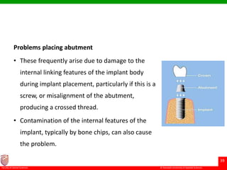© Ramaiah University of Applied Sciences
39
Faculty of Dental Sciences
Problems placing abutment
• These frequently arise due to damage to the
internal linking features of the implant body
during implant placement, particularly if this is a
screw, or misalignment of the abutment,
producing a crossed thread.
• Contamination of the internal features of the
implant, typically by bone chips, can also cause
the problem.
 