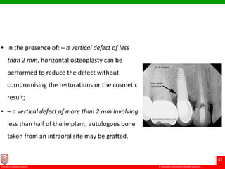 © Ramaiah University of Applied Sciences
42
Faculty of Dental Sciences
• In the presence of: – a vertical defect of less
than 2 mm, horizontal osteoplasty can be
performed to reduce the defect without
compromising the restorations or the cosmetic
result;
• – a vertical defect of more than 2 mm involving
less than half of the implant, autologous bone
taken from an intraoral site may be grafted.
 
