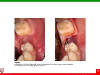 © Ramaiah University of Applied Sciences
48
Faculty of Dental Sciences
 