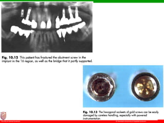 © Ramaiah University of Applied Sciences
62
Faculty of Dental Sciences
 