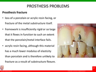 © Ramaiah University of Applied Sciences
67
Faculty of Dental Sciences
PROSTHESIS PROBLEMS
Prosthesis fracture
• loss of a porcelain or acrylic resin facing, or
fracture of the metal substructure itself.
• framework is insufficiently rigid or so large
that it flexes in function to such an extent
that the porcelain/metal interface fails.
• acrylic resin facing, although this material
has a much lower modulus of elasticity
than porcelain and is therefore unlikely to
fracture as a result of substructure flexure.
 