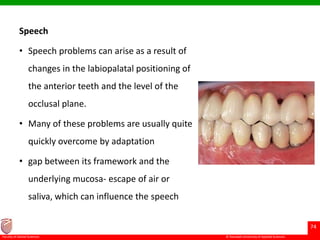 © Ramaiah University of Applied Sciences
74
Faculty of Dental Sciences
Speech
• Speech problems can arise as a result of
changes in the labiopalatal positioning of
the anterior teeth and the level of the
occlusal plane.
• Many of these problems are usually quite
quickly overcome by adaptation
• gap between its framework and the
underlying mucosa- escape of air or
saliva, which can influence the speech
 