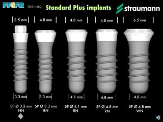Standard Plus implants 3.3 mm 3.5 mm SP Ø 3.3 mm NN 3.3 mm 4.8 mm SP Ø 3.3 mm RN 4.1 mm 4.8 mm SP Ø 4.1 mm RN 4.8 mm 4.8 mm SP Ø 4.8 mm RN 4.8 mm 6.5 mm SP Ø 4.8 mm WN 