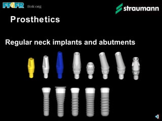 Prosthetics Regular neck implants and abutments  