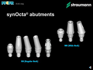 synOcta ®  abutments RN (Regular Neck) WN (Wide Neck) 