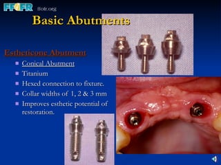 Basic Abutments Estheticone Abutment Conical Abutment Titanium Hexed connection to fixture. Collar widths of 1, 2 & 3 mm Improves esthetic potential of restoration. 