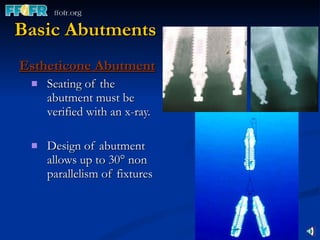 Basic Abutments Estheticone Abutment Seating of the abutment must be verified with an x-ray. Design of abutment allows up to 30 ° non parallelism of fixtures 