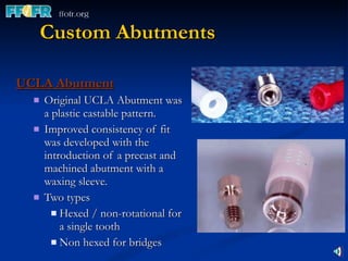 Custom Abutments UCLA Abutment Original UCLA Abutment was a plastic castable pattern. Improved consistency of fit was developed with the introduction of a precast and machined abutment with a waxing sleeve. Two types Hexed / non-rotational for a single tooth Non hexed for bridges 