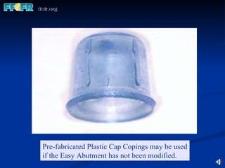 Pre-fabricated Plastic Cap Copings may be used if the Easy Abutment has not been modified. 